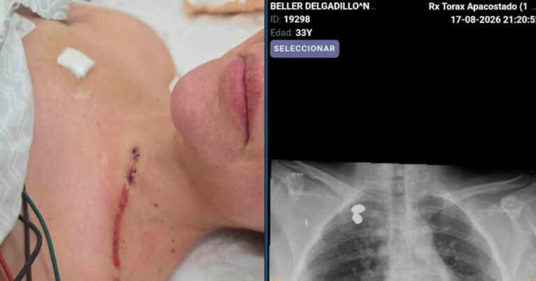 Caso Cerimedo: Nadia Beller mostró las imágenes de sus heridas tras el ataque
